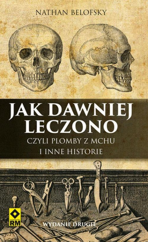 Jak dawniej leczono czyli plomby z mchu i inne historie